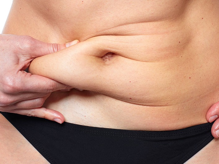 Plástica na barriga na Barra da Tijuca