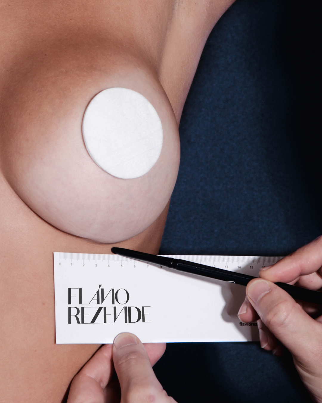 MAMOPLASTIA DE AUMENTO