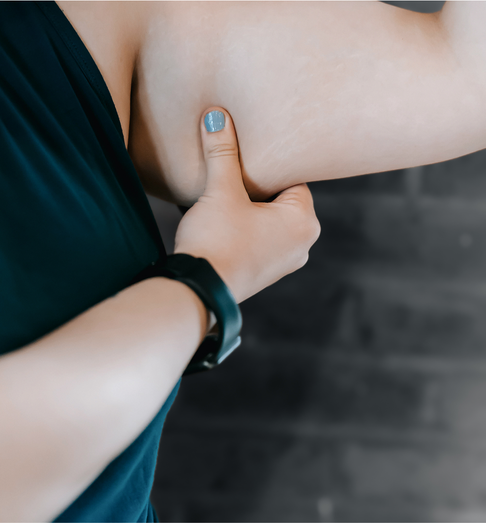 BRAQUIOPLASTIA
