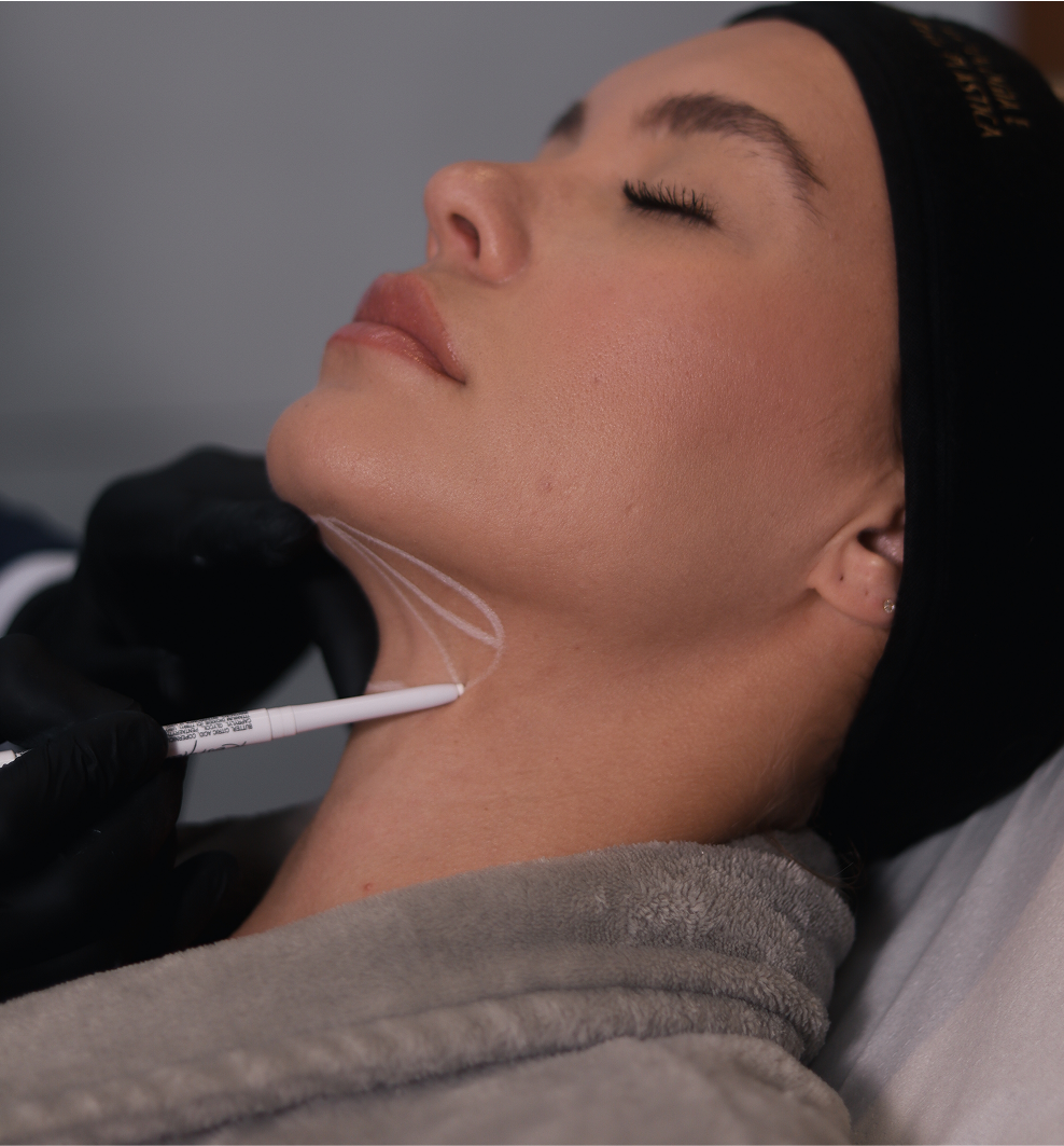 LIPO DE PAPADA A LASER