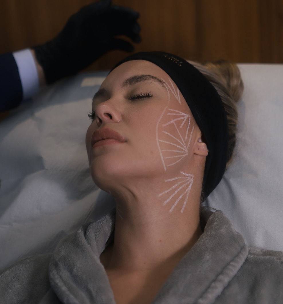 SCULPTRA