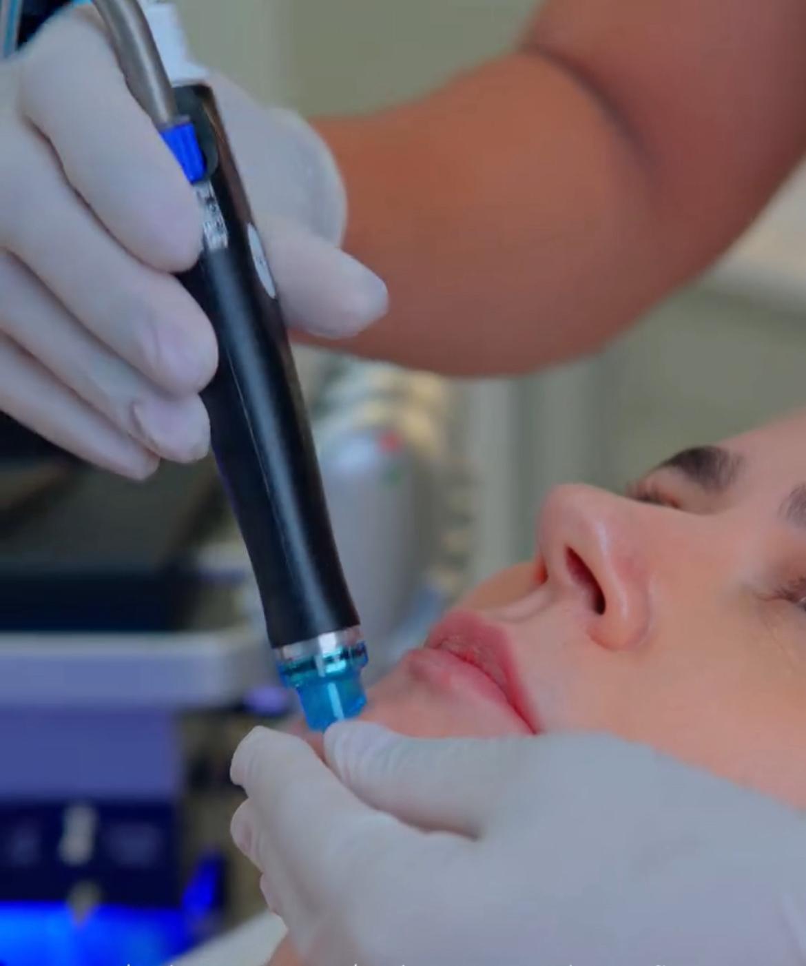 HYDRAFACIAL