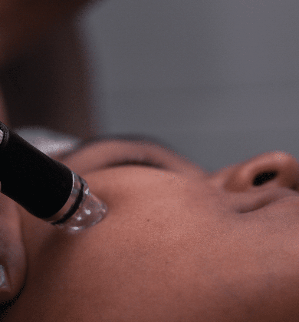 HYDRAFACIAL