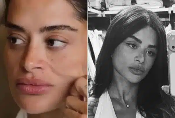 Lifting facial aos 38 anos? Cirurgia de Aline Campos reacende debate sobre idade ideal; entenda